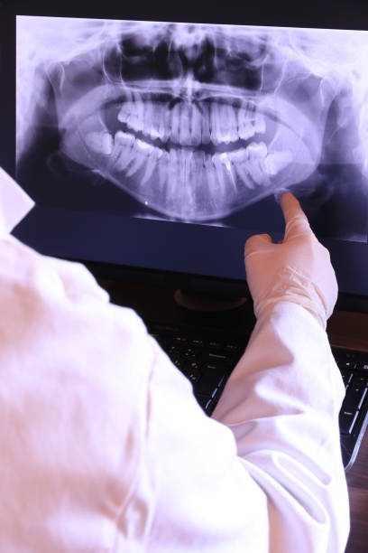 Best Emergency Tooth Extraction in Winfield, KS