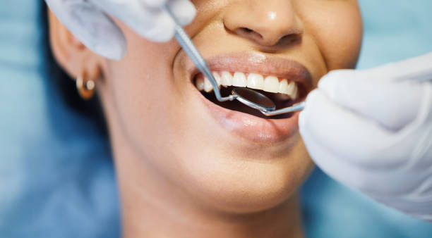 Best Emergency Broken Tooth Repair in Winfield, KS