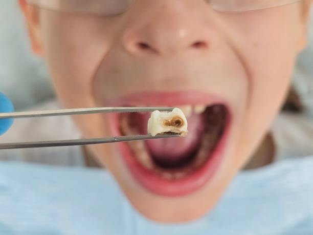 Best Emergency Dental Care for Trauma or Injury in Winfield, KS