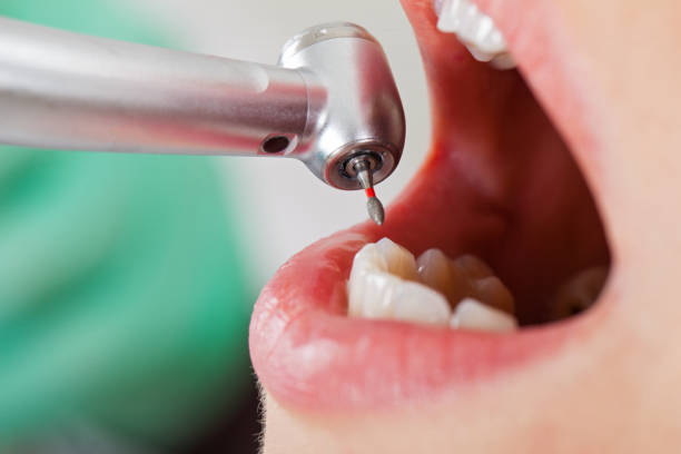 Best Weekend Emergency Dentist in Winfield, KS